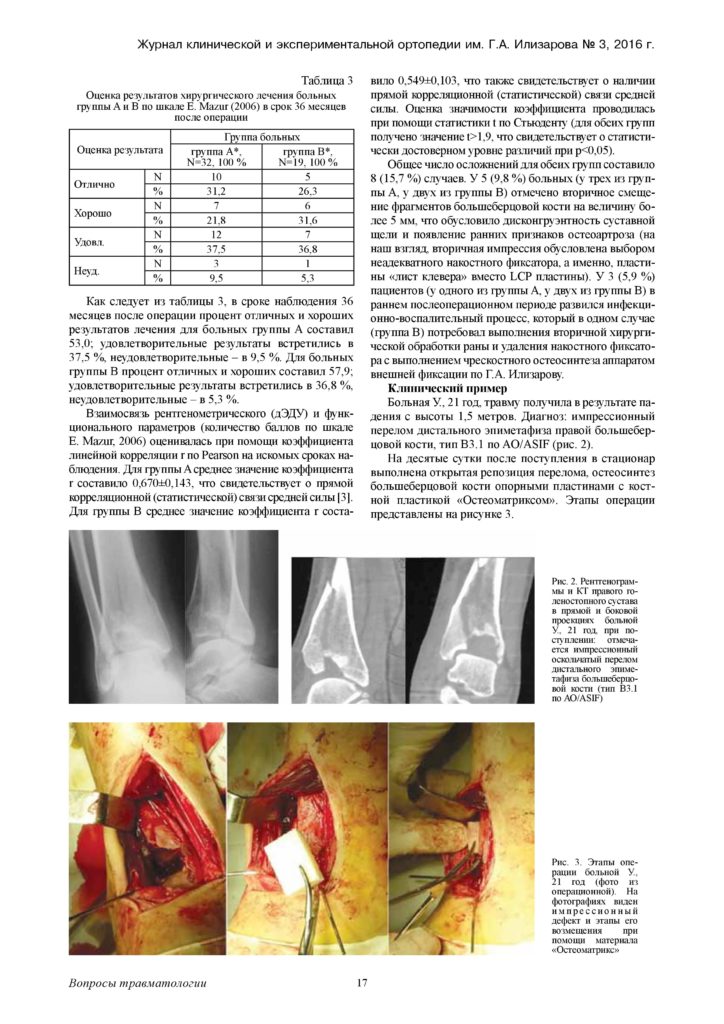 augmentaciya-kostnyx-defektov-distalnogo-otdela-page-3